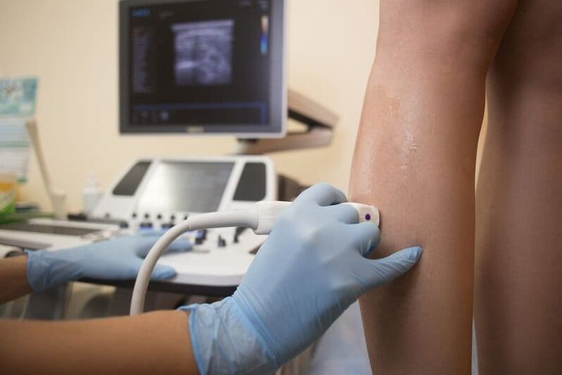 Ultrasound diagnosis of varicose veins